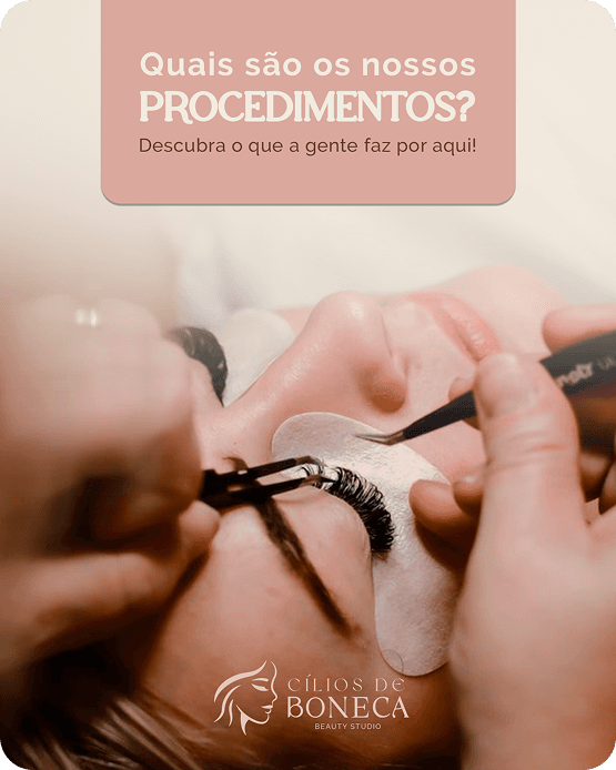 Post sobre os procedimentos